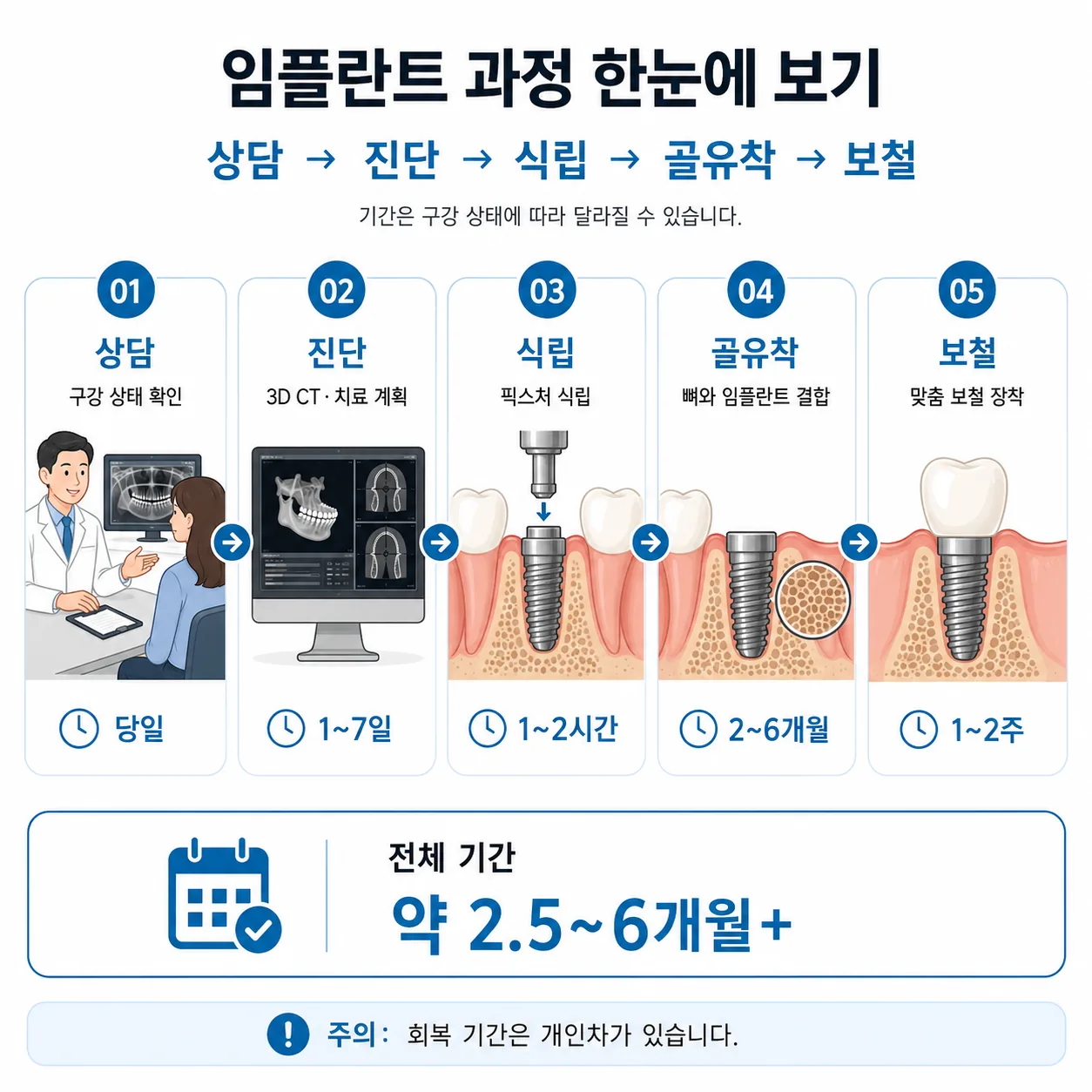 임플란트 과정 전체 흐름 상담 진단 식립 골유착 보철 단계 다이어그램