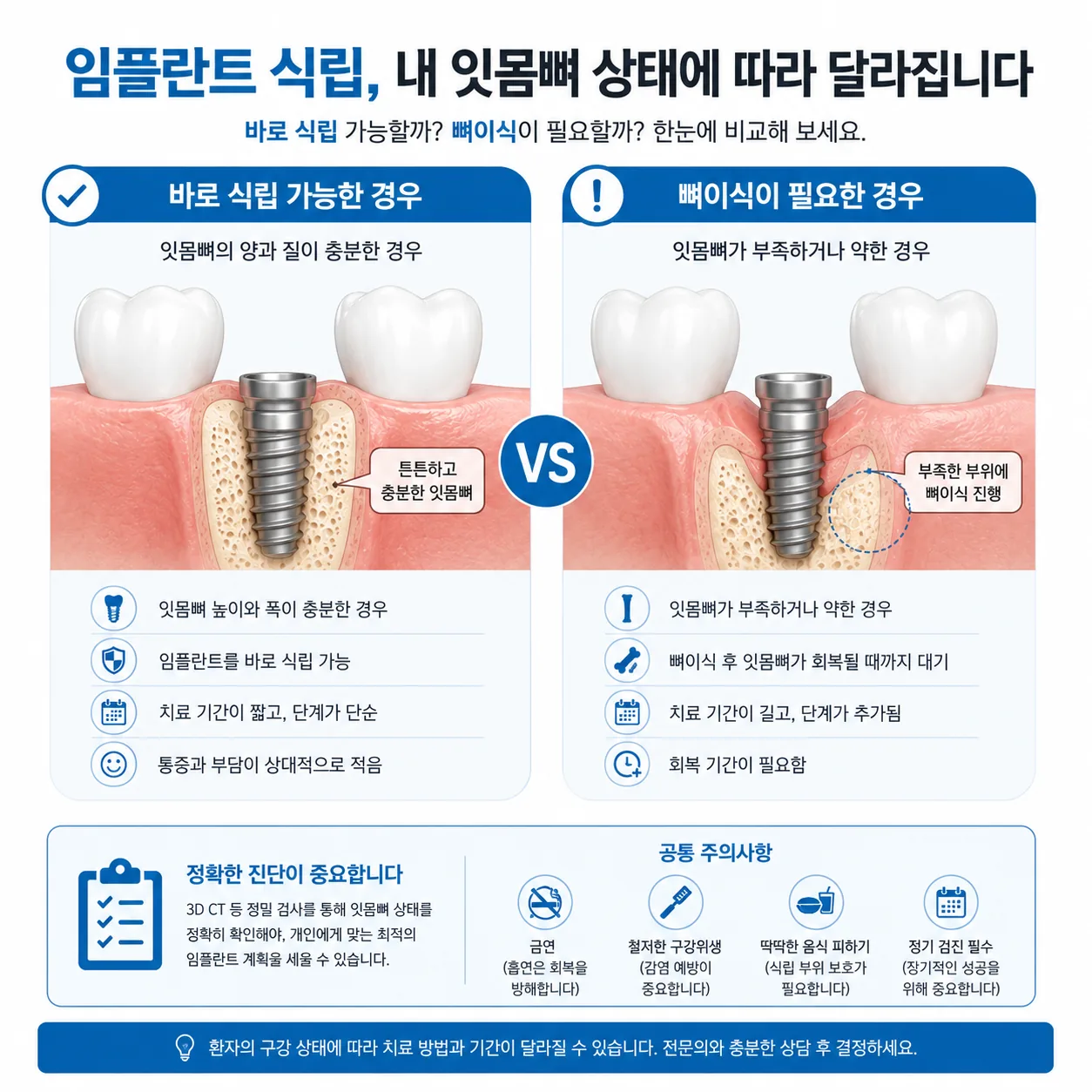 임플란트 바로 식립 가능 경우와 뼈이식 필요 경우 비교 인포그래픽