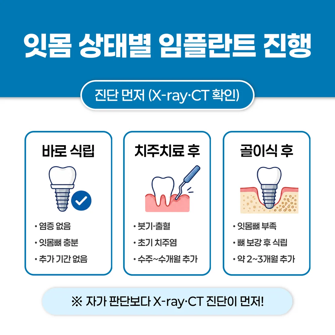 잇몸 상태별 임플란트 진행 방법 비교