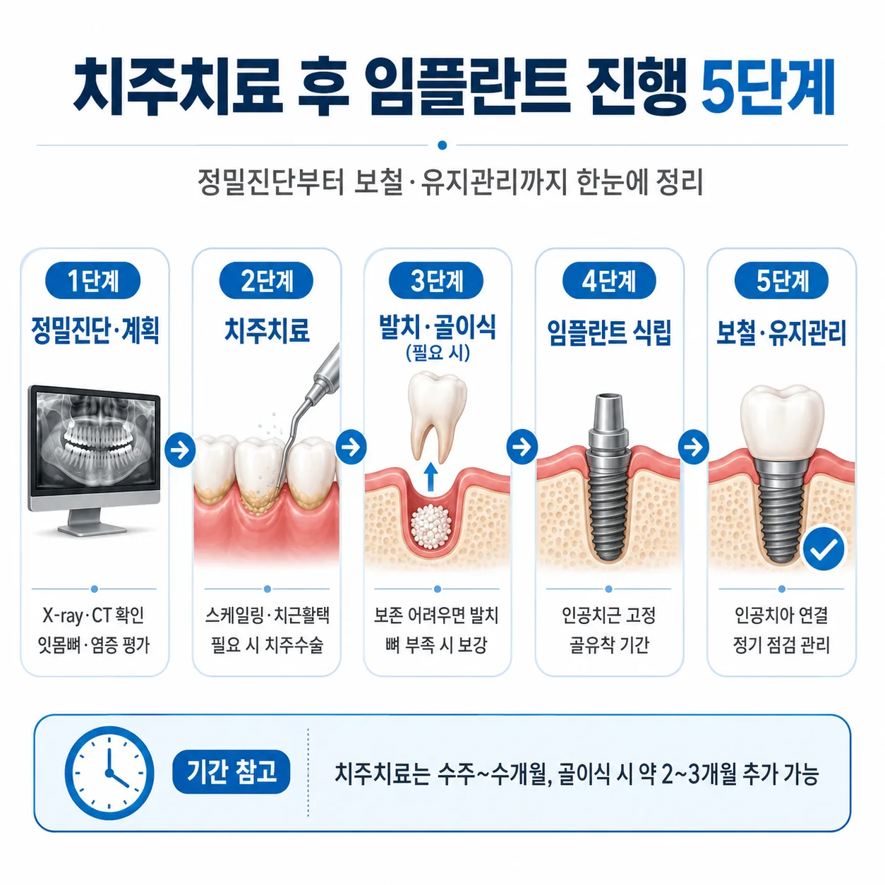 치주치료 후 임플란트 진행 5단계 순서