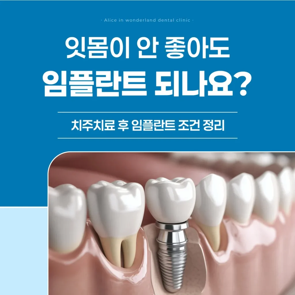 잇몸이 안 좋아도 임플란트 되나요? 치주치료 후 임플란트 조건 정리