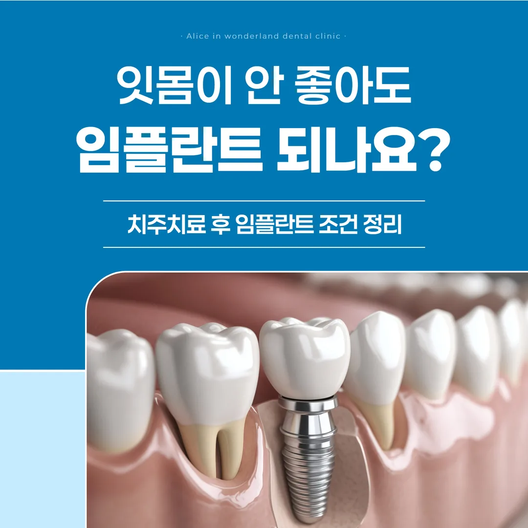 잇몸이 안 좋아도 임플란트 되나요? 치주치료 후 임플란트 조건 정리