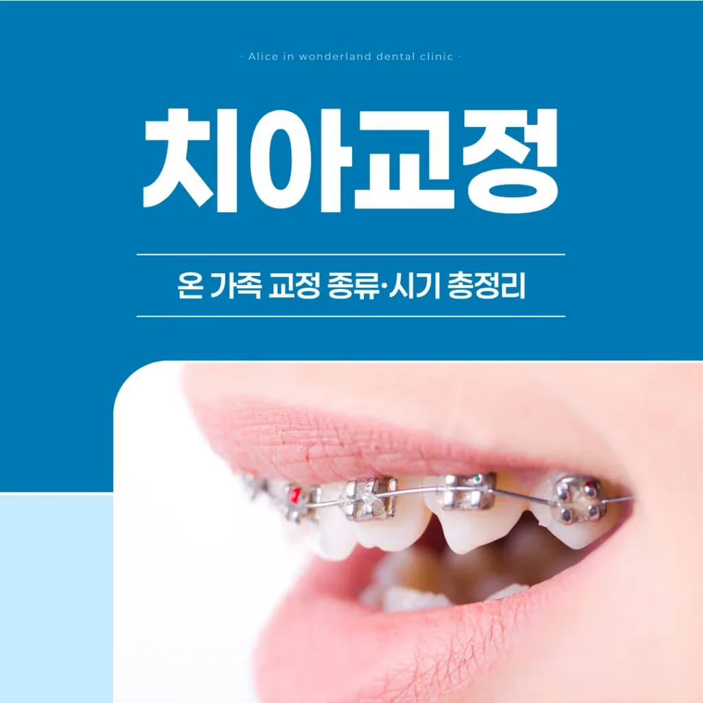 성북구 치아교정, 온 가족 교정 종류·시기 총정리
