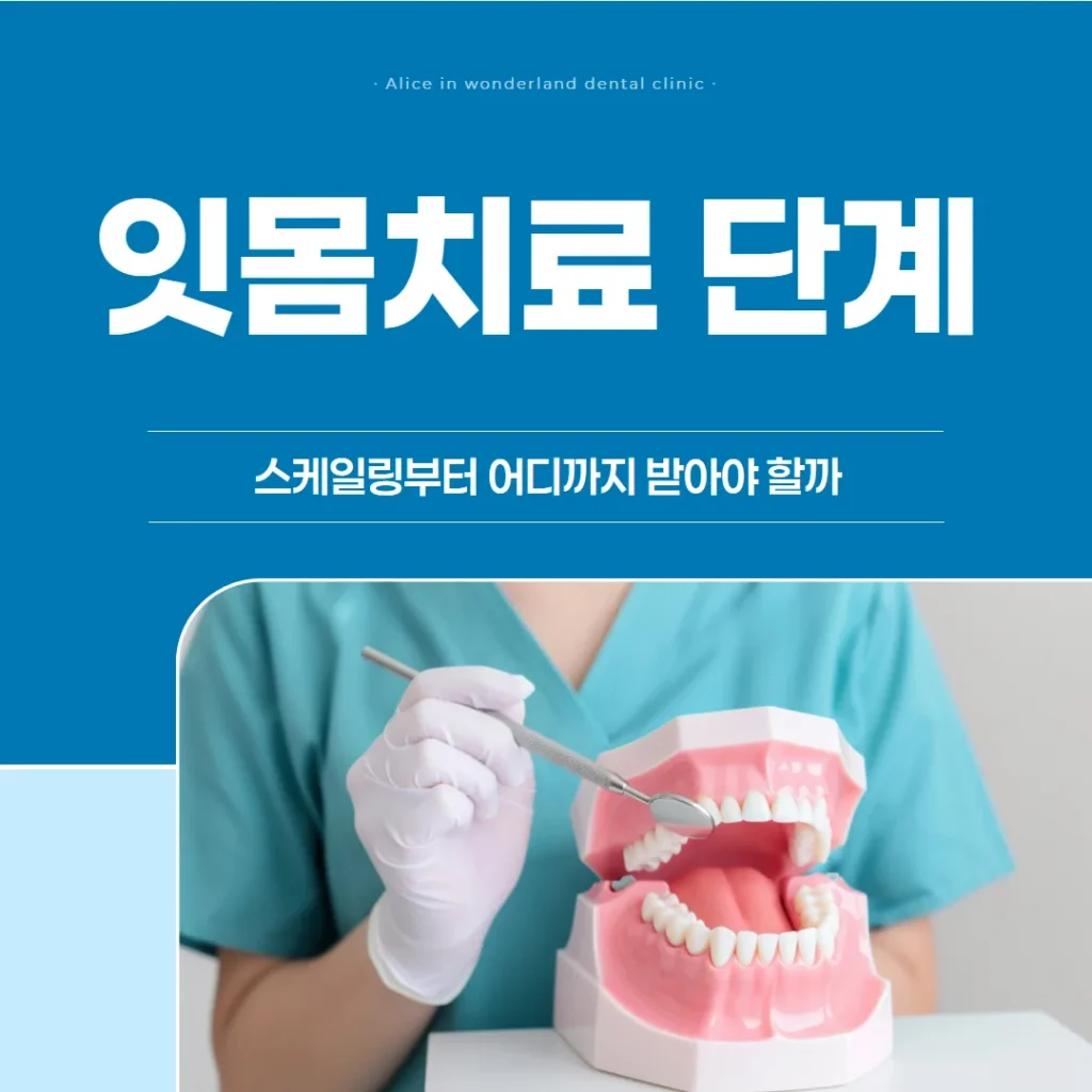 잇몸치료 단계, 스케일링부터 어디까지 받아야 할까