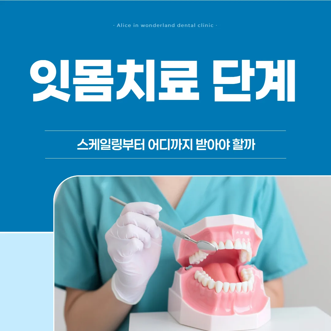 잇몸치료 단계, 스케일링부터 어디까지 받아야 할까