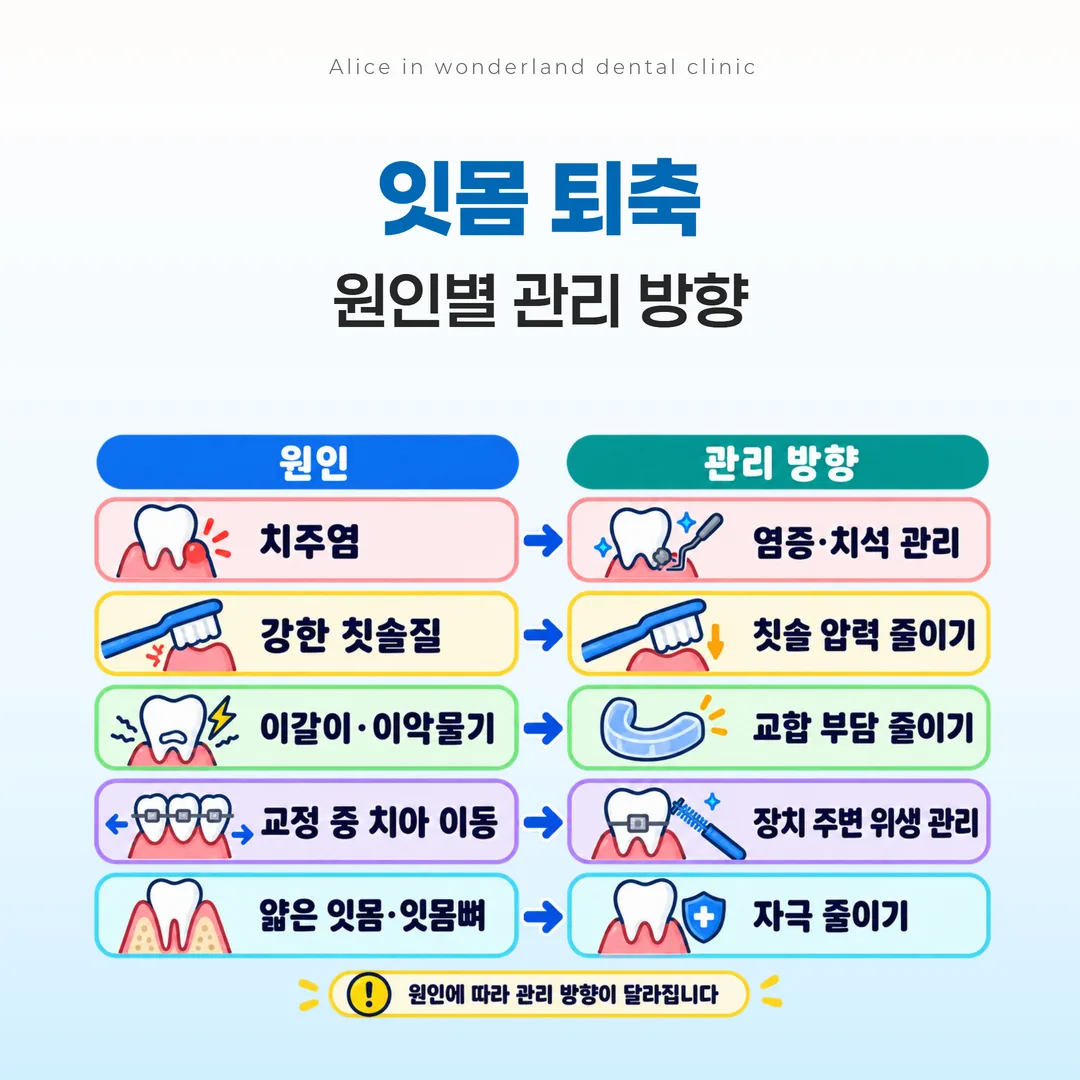 잇몸 퇴축 원인 다섯 갈래별 관리 방향 비교 도해