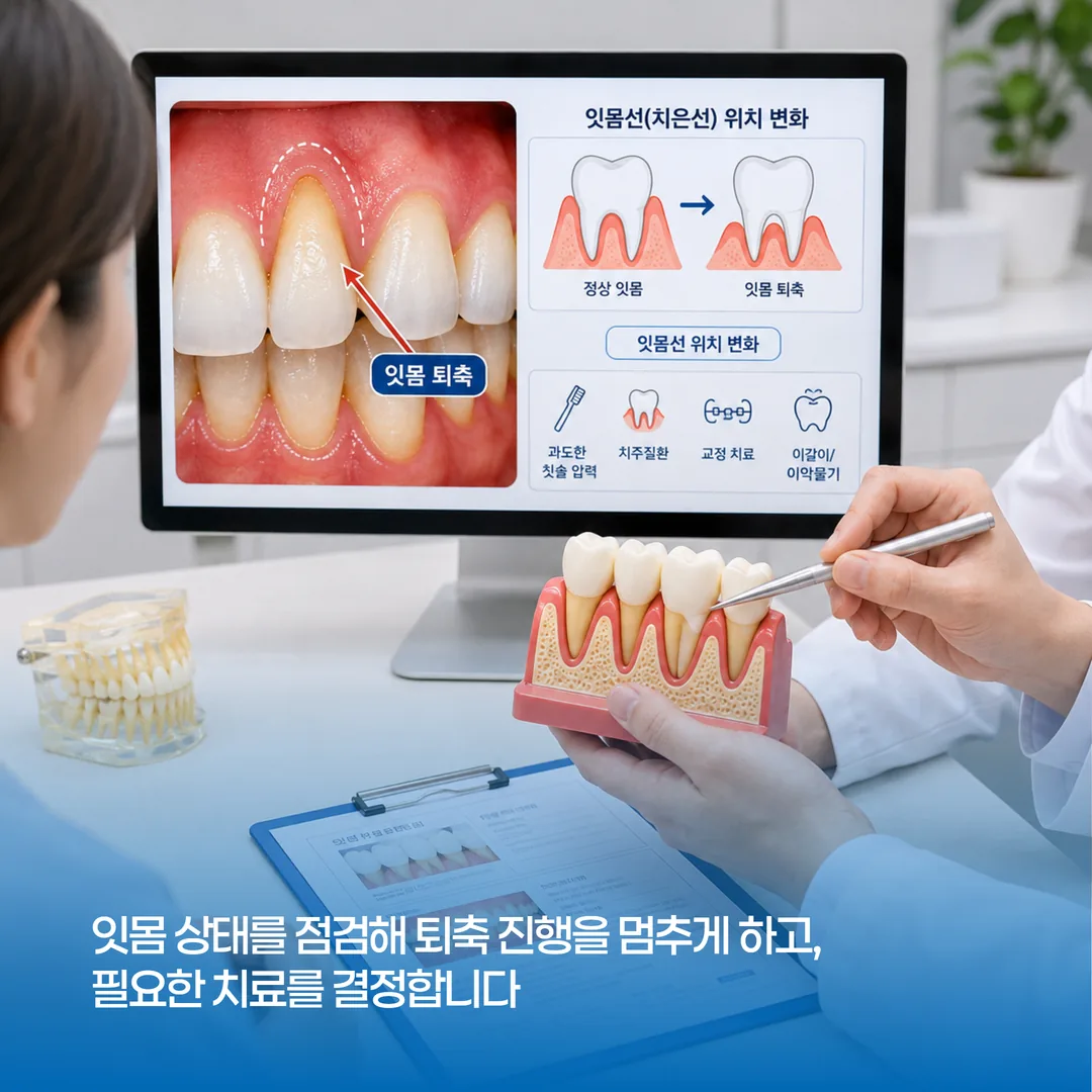 상담실에서 잇몸선이 내려간 부위를 설명하는 모습