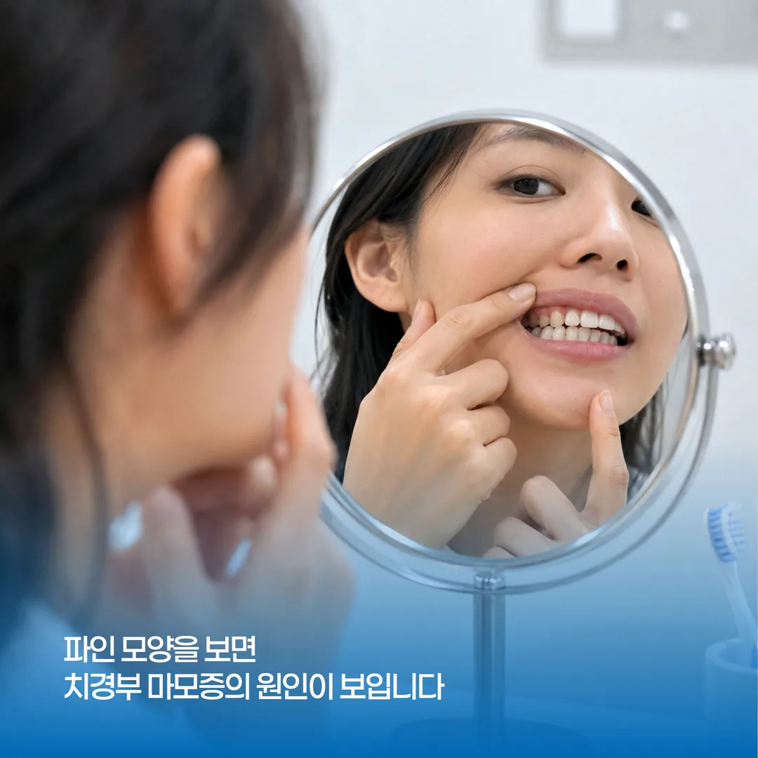 거울을 보며 손톱으로 치아 목 부위의 파임을 확인하는 자가 점검 장면
