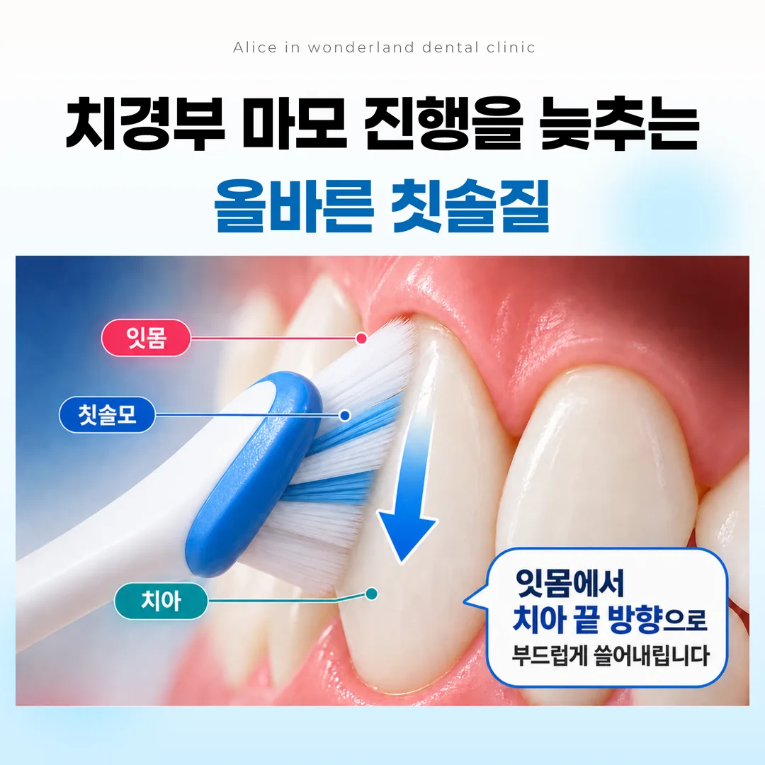 잇몸에서 치아 끝 방향으로 쓸어내리는 올바른 칫솔질 방향 도해