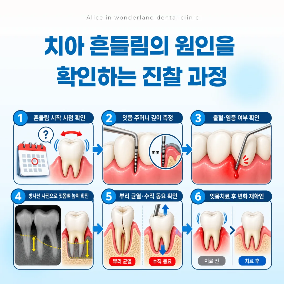 치주 탐침과 방사선 사진으로 잇몸뼈 높이를 확인하는 과정