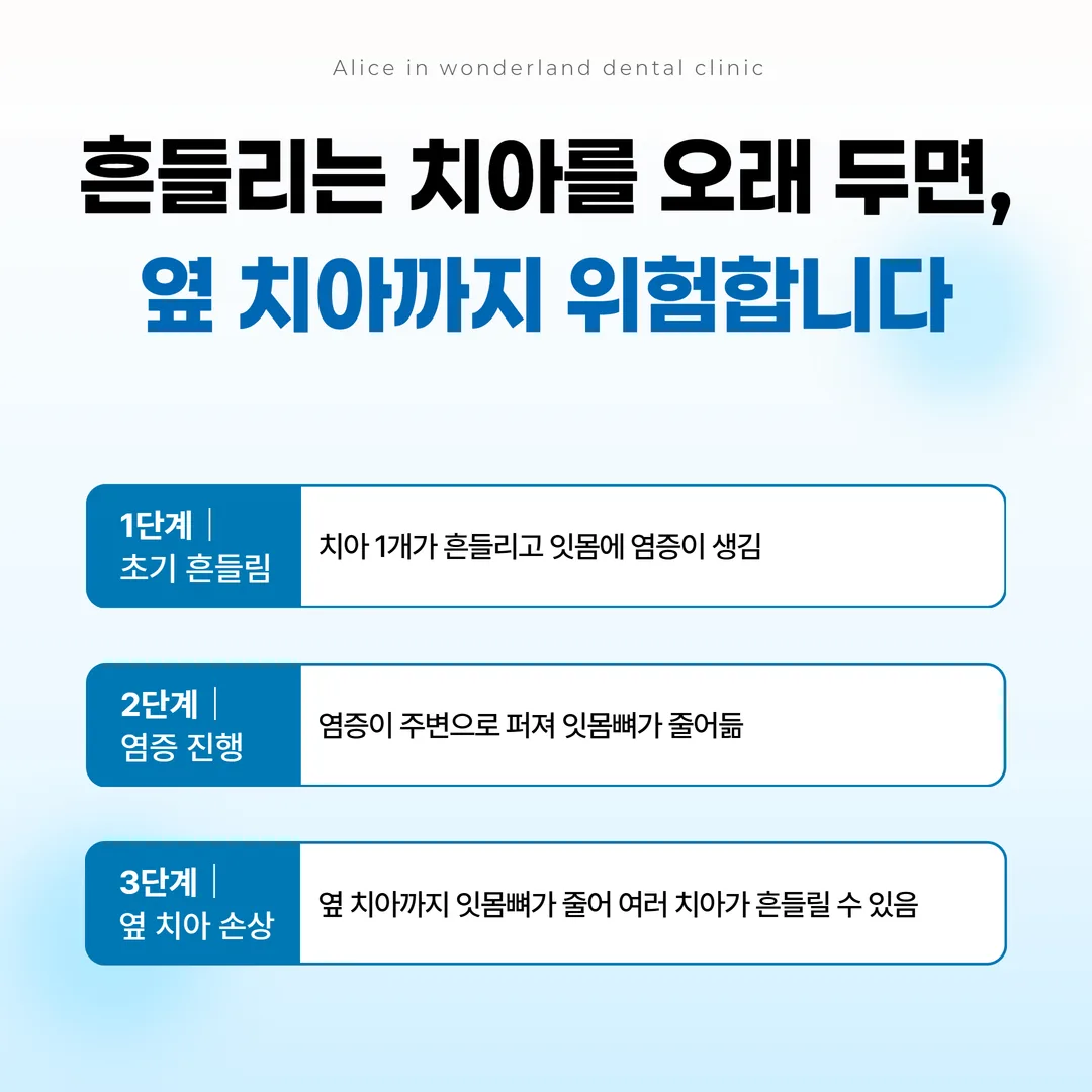흔들리는 치아를 방치했을 때 인접 치아 잇몸뼈의 변화
