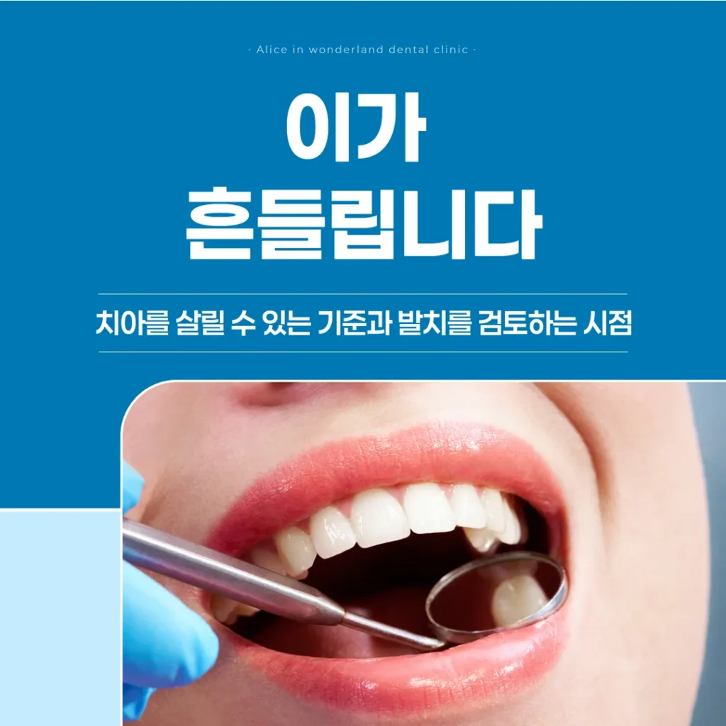 이가 흔들립니다 — 치아를 살릴 수 있는 기준과 발치를 검토하는 시점