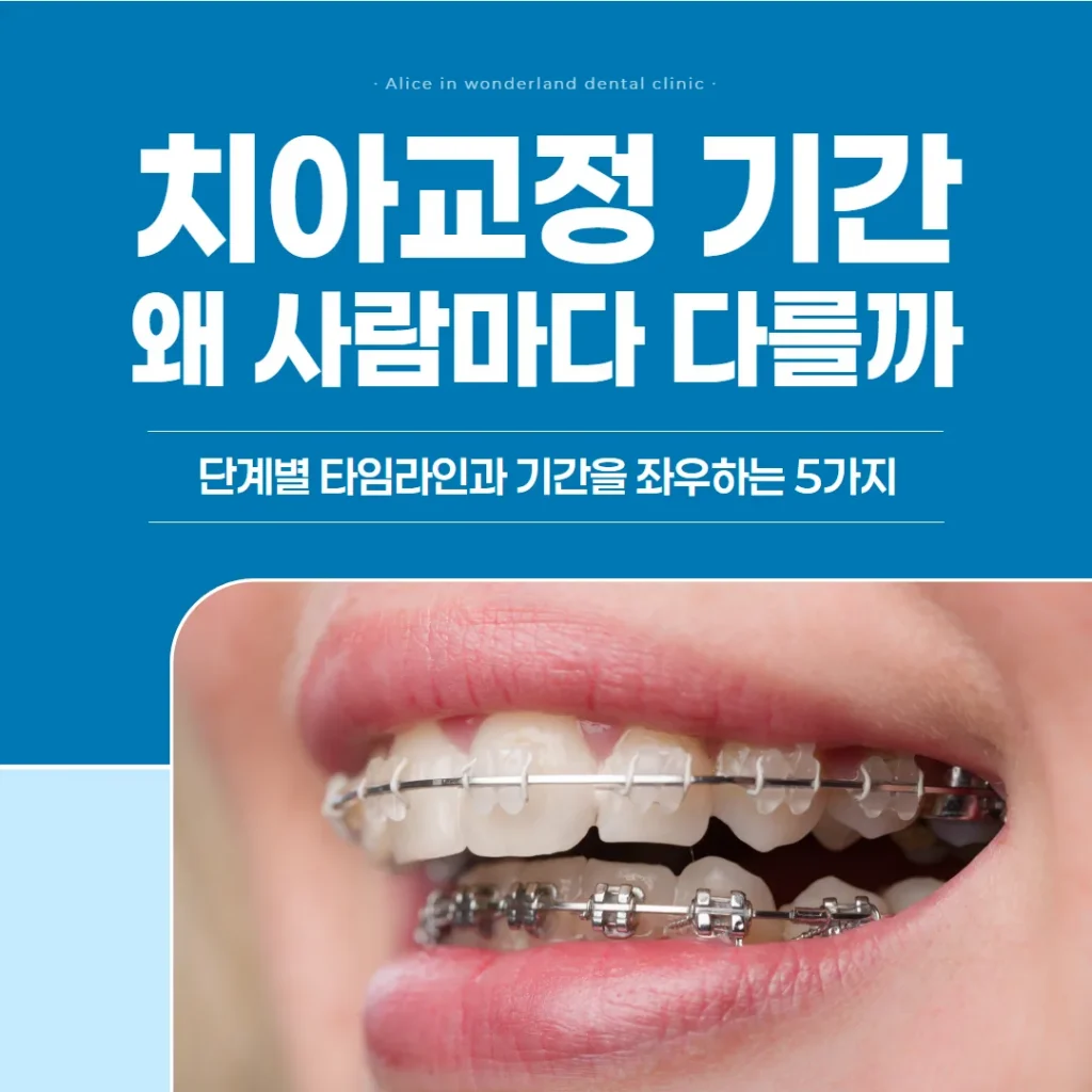 치아교정 기간, 왜 사람마다 다를까 — 단계별 타임라인과 기간을 좌우하는 5가지