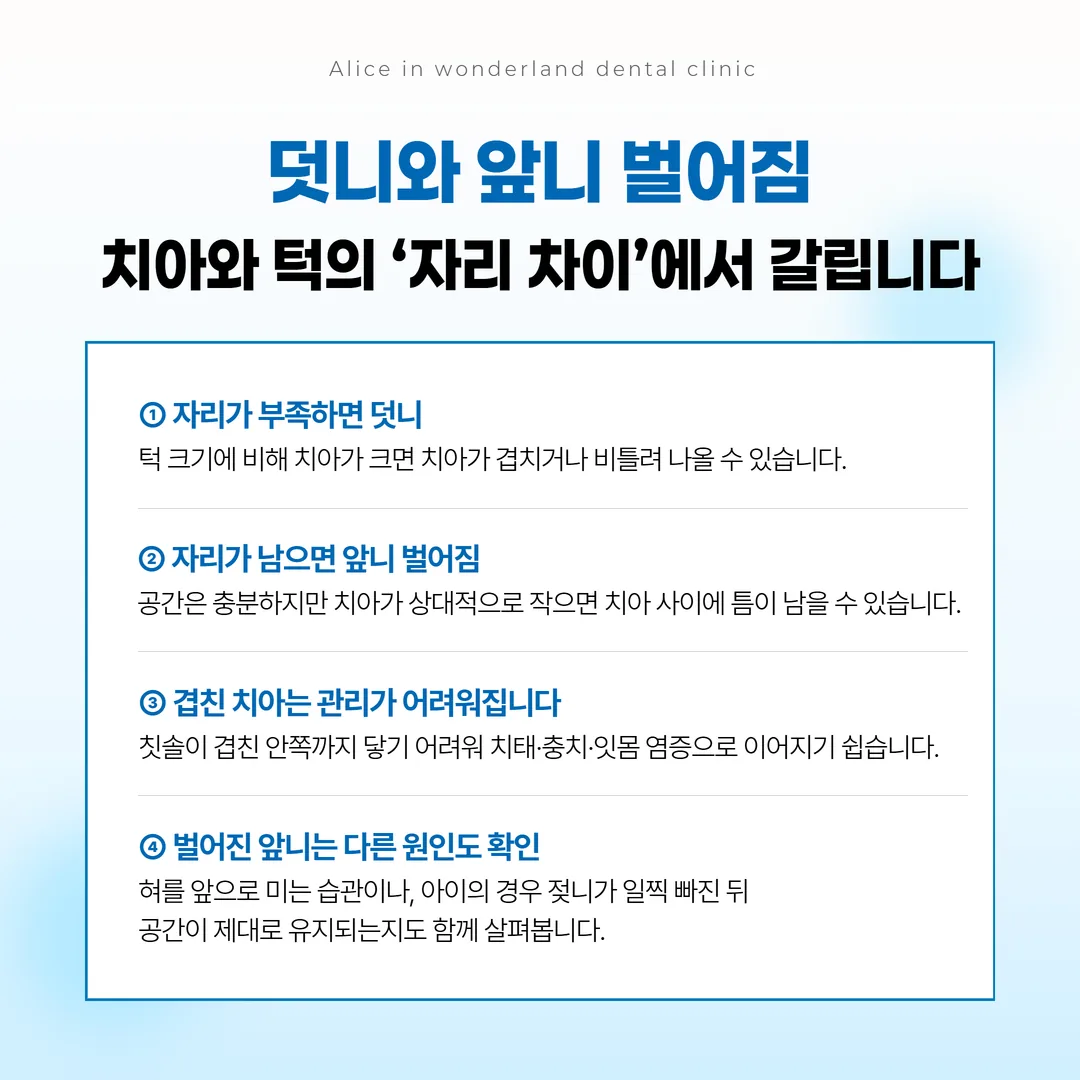 치아가 겹친 부위에서 치실이 걸리는 자리를 보여주는 구강 모형