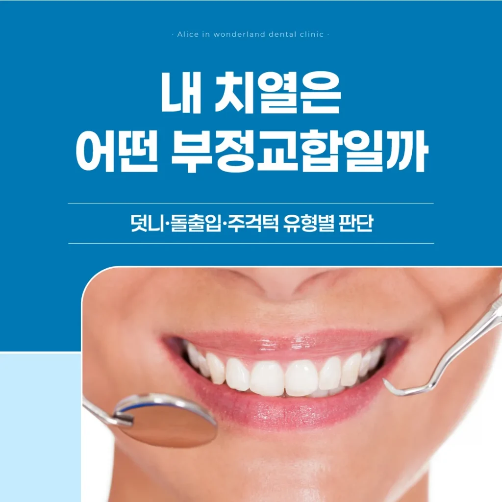 내 치열은 어떤 부정교합일까 — 덧니·돌출입·주걱턱 유형별 판단