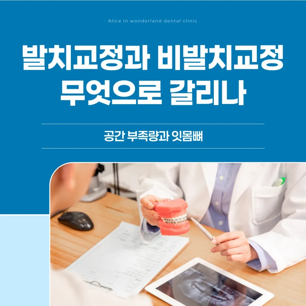발치교정과 비발치교정, 무엇으로 갈리나 — 공간 부족량과 잇몸뼈