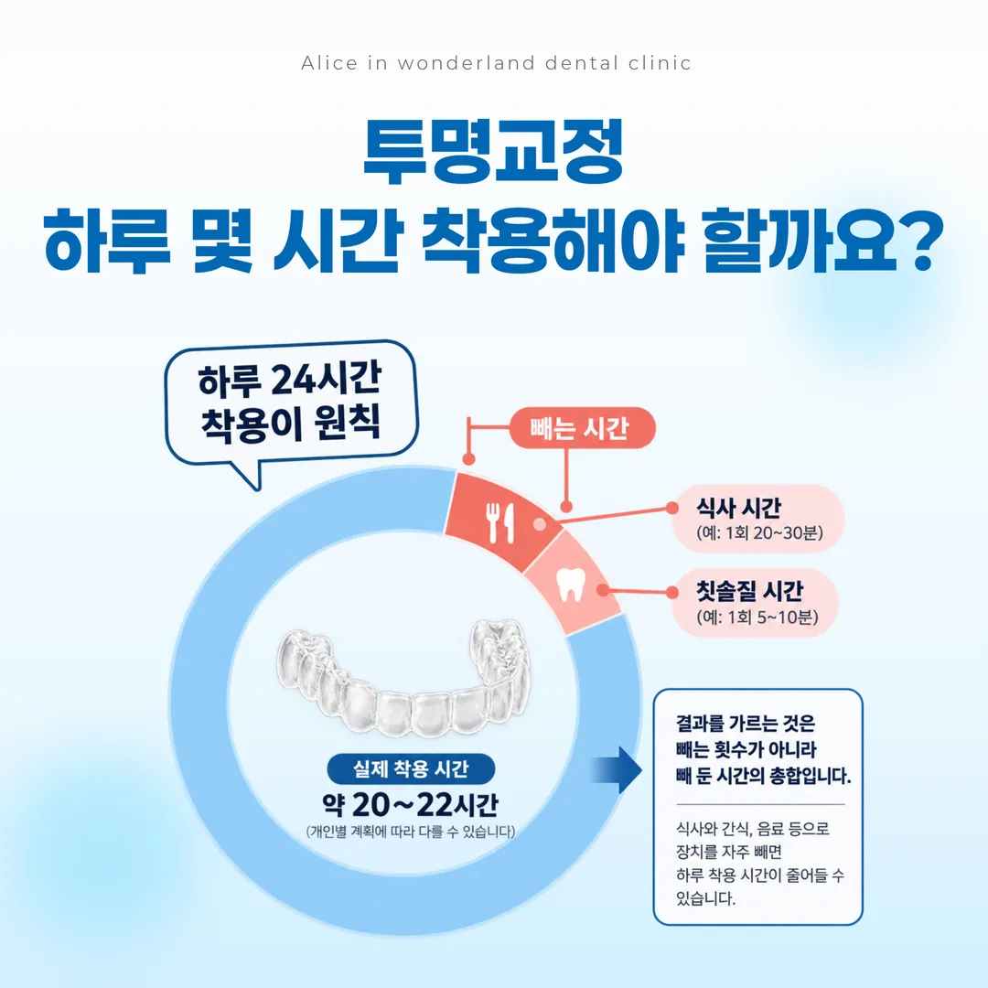 투명교정 하루 착용 시간에서 식사와 칫솔질 시간이 빠지는 구조 도식