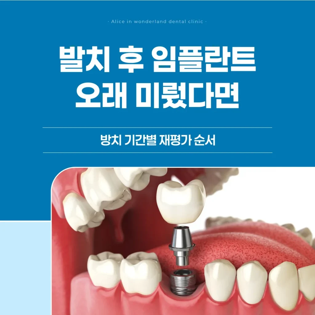 발치 후 임플란트, 오래 미뤘다면 — 방치 기간별 재평가 순서
