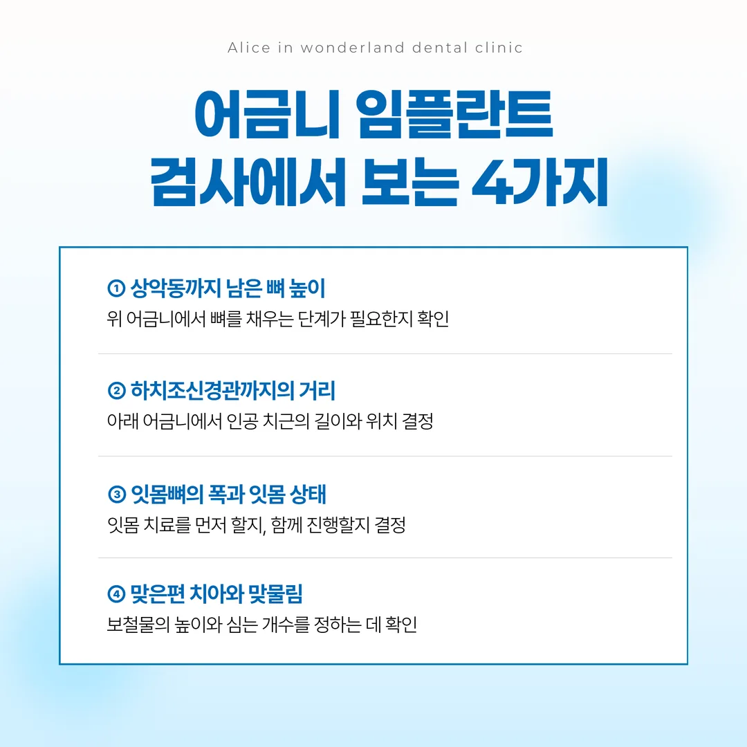 어금니 임플란트 검사 항목 네 가지와 그 값이 바꾸는 결정을 연결한 관계도