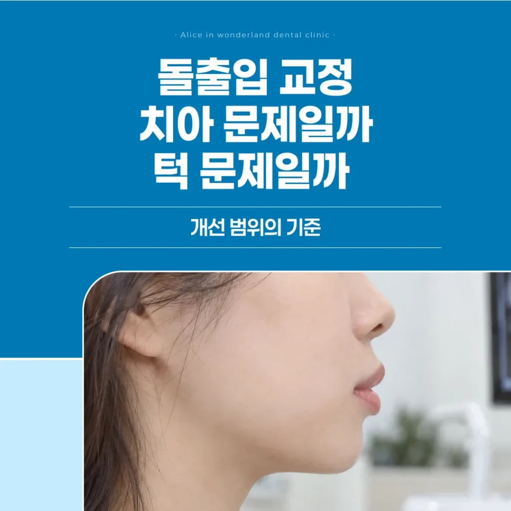 돌출입 교정, 치아 문제일까 턱 문제일까 — 개선 범위의 기준