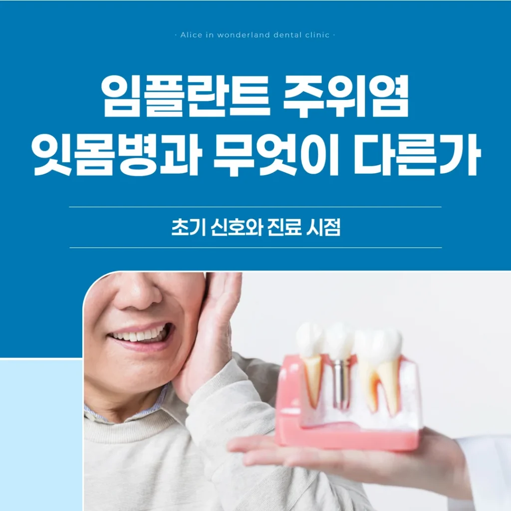 임플란트 주위염, 잇몸병과 무엇이 다른가 — 초기 신호와 진료 시점