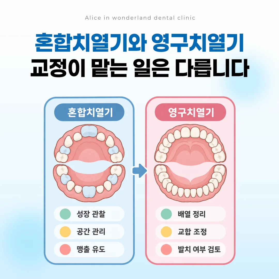혼합치열기 치열과 영구치열기 치열을 비교한 개념도