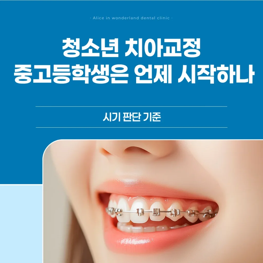 청소년 치아교정, 중고등학생은 언제 시작하나 — 시기 판단 기준