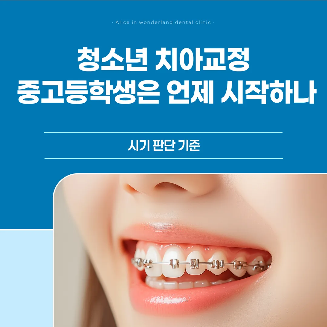 청소년 치아교정, 중고등학생은 언제 시작하나 — 시기 판단 기준