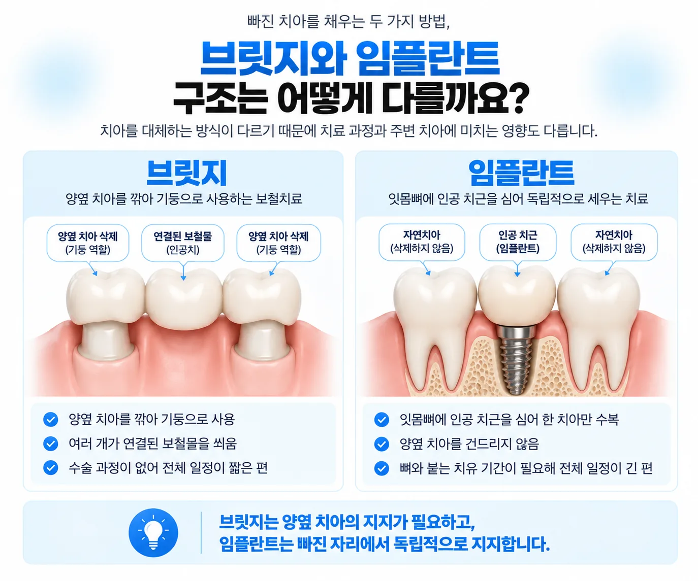 브릿지와 임플란트의 구조 차이를 비교한 치과 보철 안내 그림