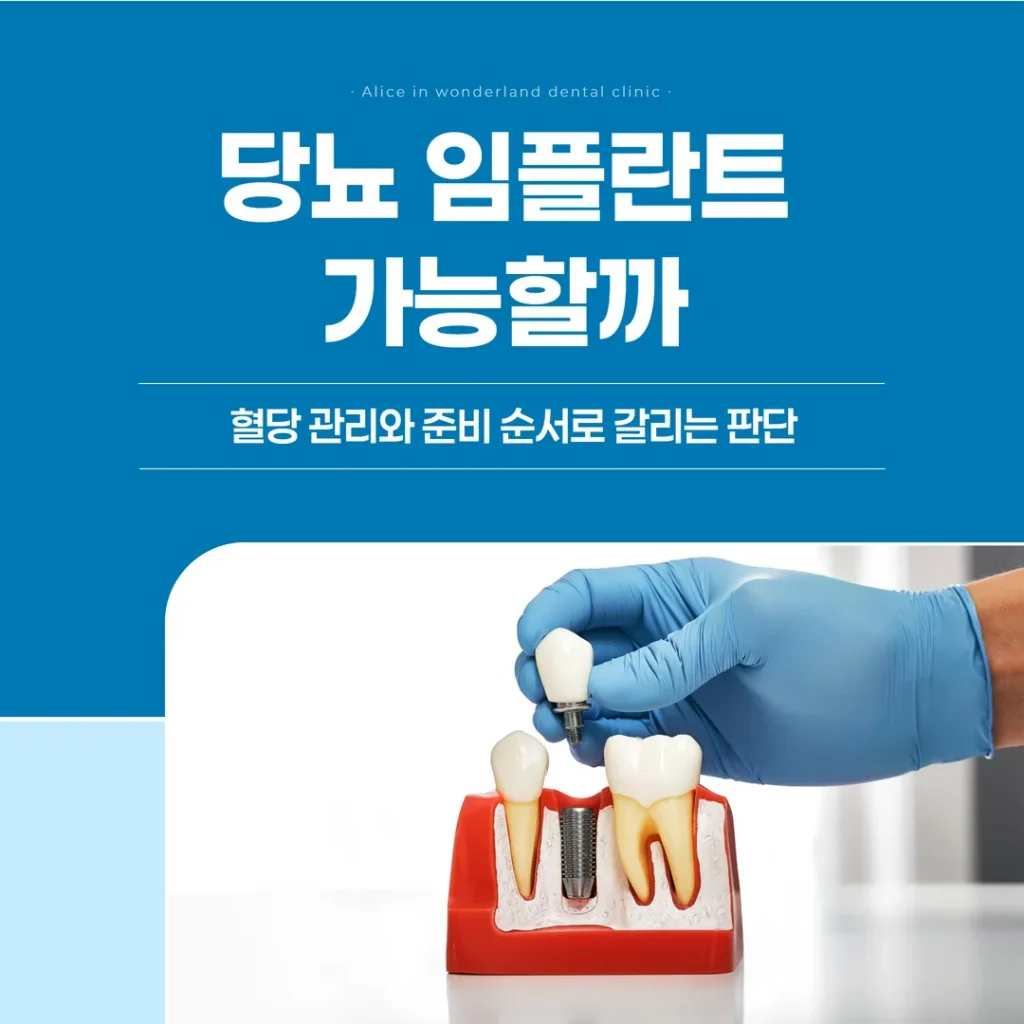 당뇨 임플란트, 가능할까 — 혈당 관리와 준비 순서로 갈리는 판단