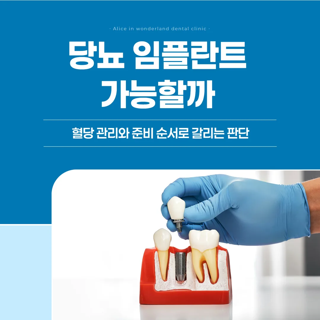당뇨 임플란트, 가능할까 — 혈당 관리와 준비 순서로 갈리는 판단