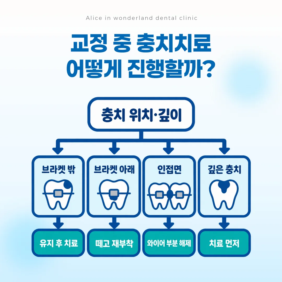 교정 중 충치의 위치와 깊이에 따라 치료 순서가 갈리는 판단 흐름도