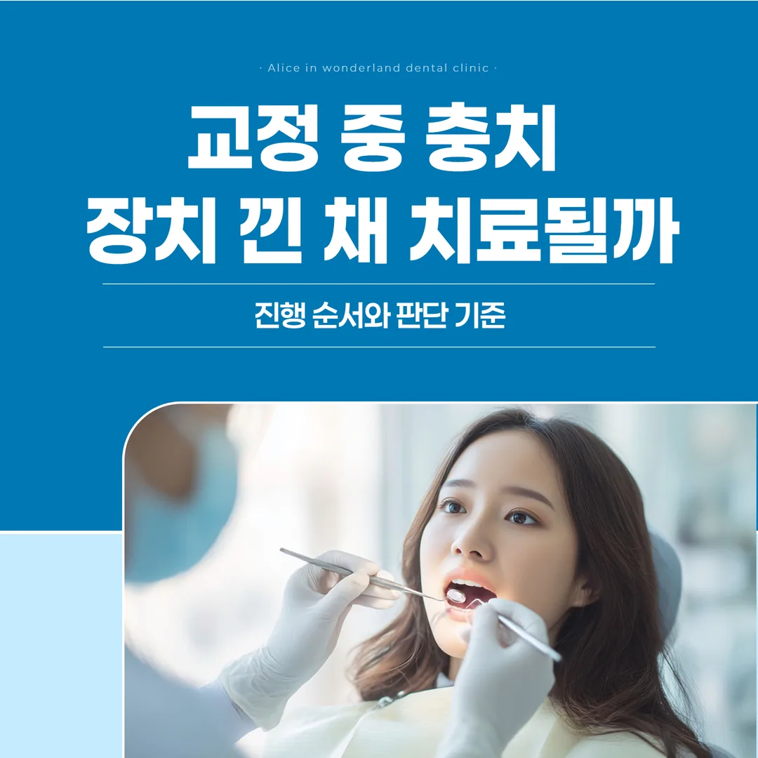 교정 중 충치, 장치 낀 채 치료될까 — 진행 순서와 판단 기준