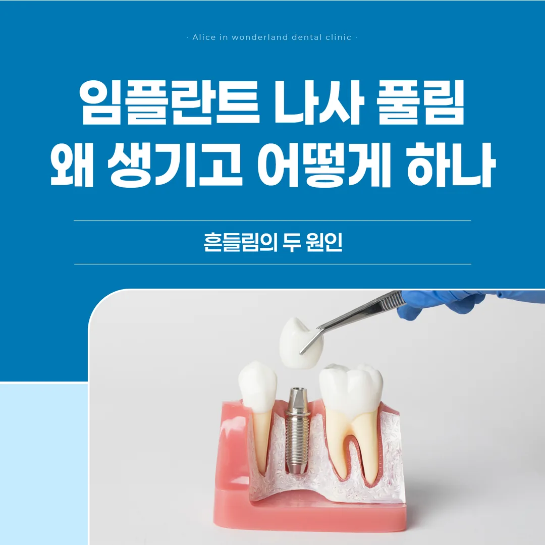 임플란트 나사 풀림, 왜 생기고 어떻게 하나 — 흔들림의 두 원인