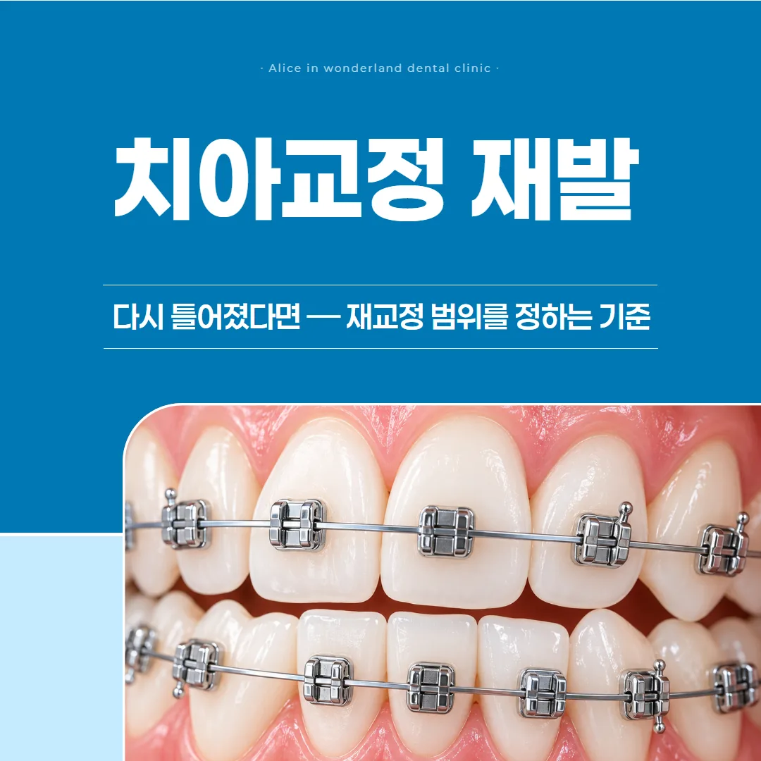 치아교정 재발, 다시 틀어졌다면 — 재교정 범위를 정하는 기준
