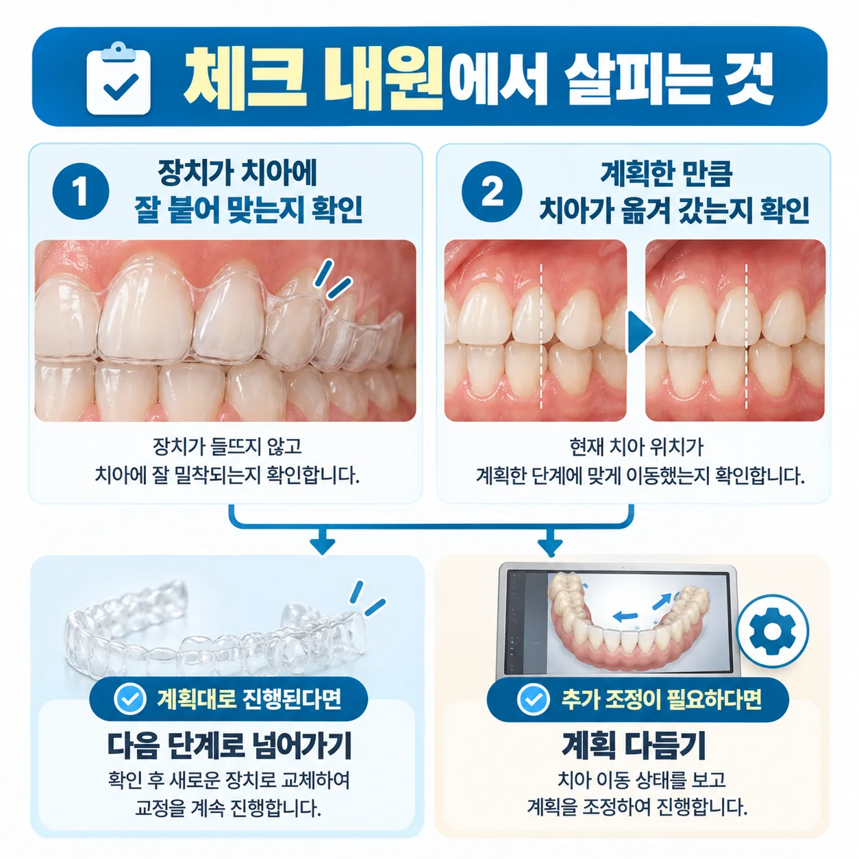 투명교정 체크 내원에서 장치가 맞는지와 치아 이동을 살펴 다음 단계를 정하는 흐름도