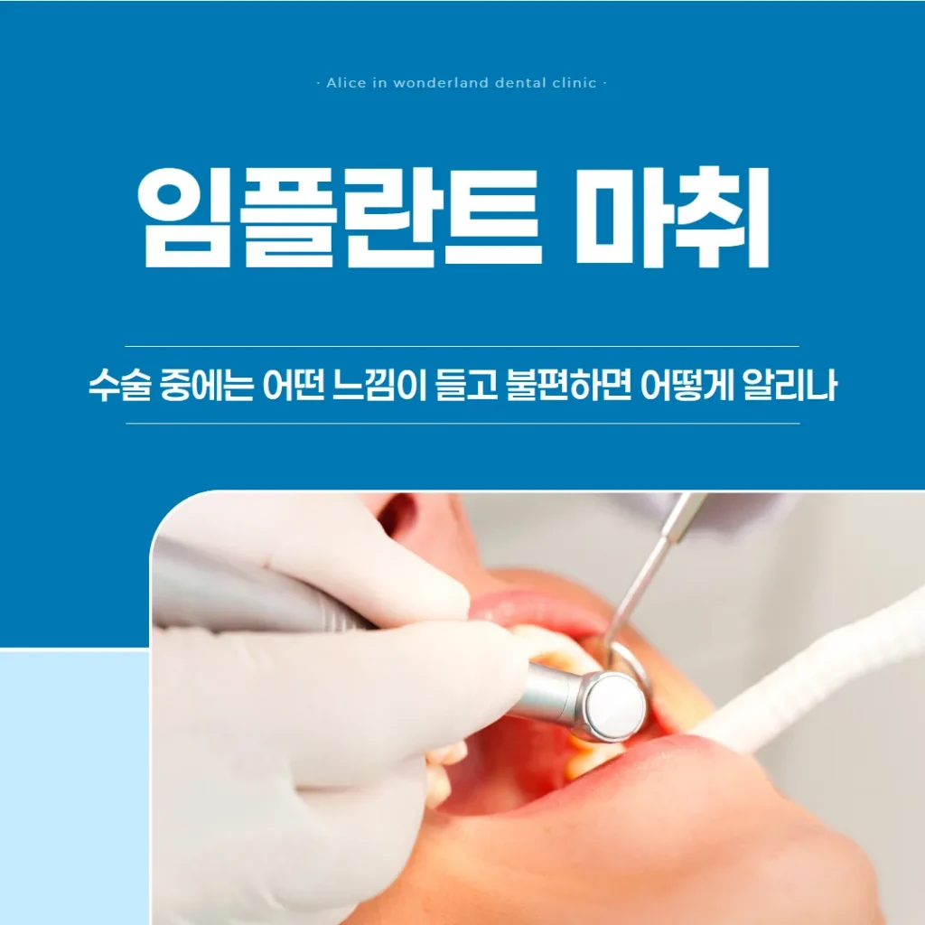 임플란트 마취, 수술 중에는 어떤 느낌이 들고 불편하면 어떻게 알리나