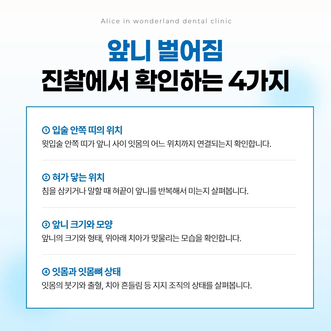 앞니 틈의 원인을 알아볼 때 진찰에서 살피는 네 곳을 표시한 입 모양 그림