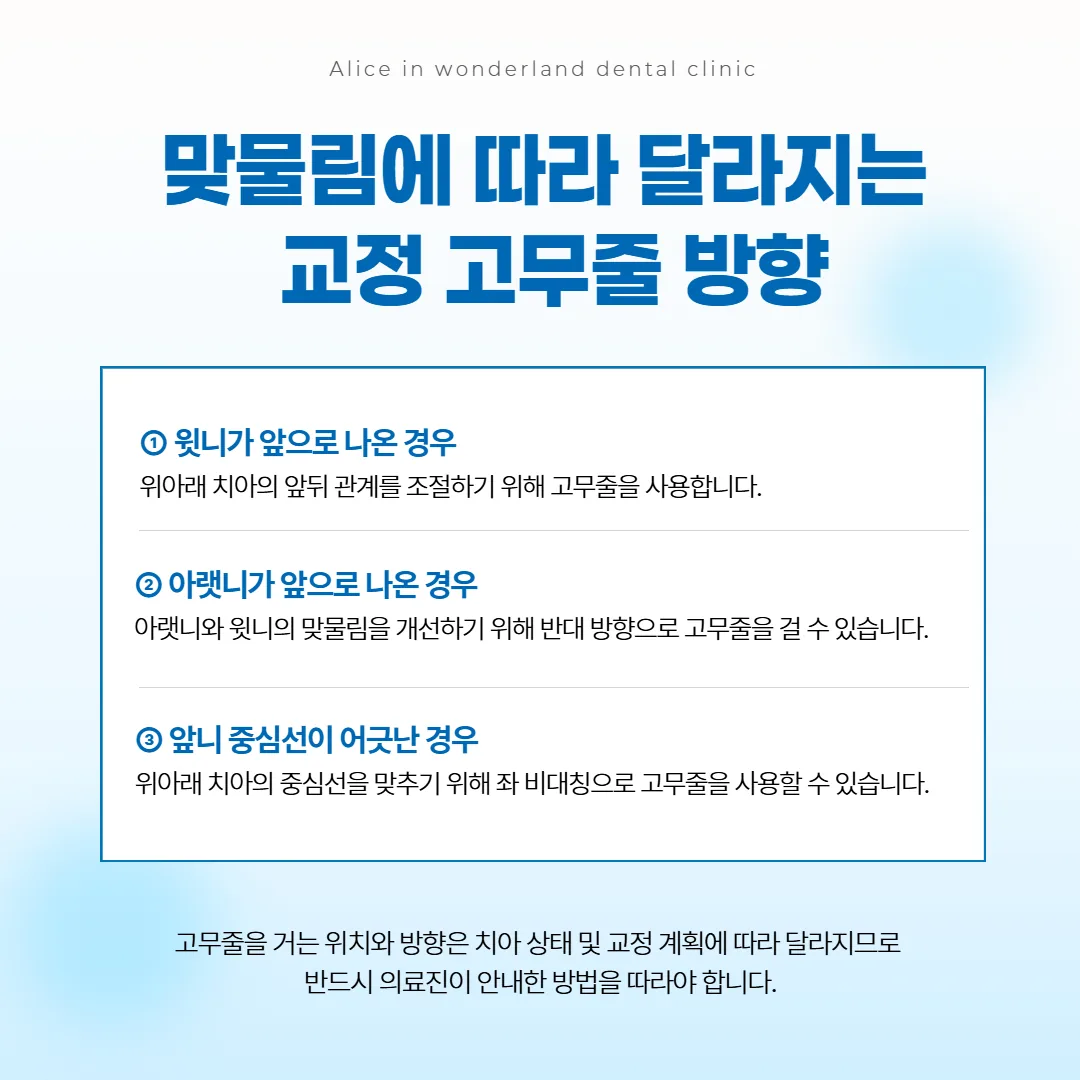 맞물림 모양에 따라 교정 고무줄을 거는 방향이 다른 세 가지 예