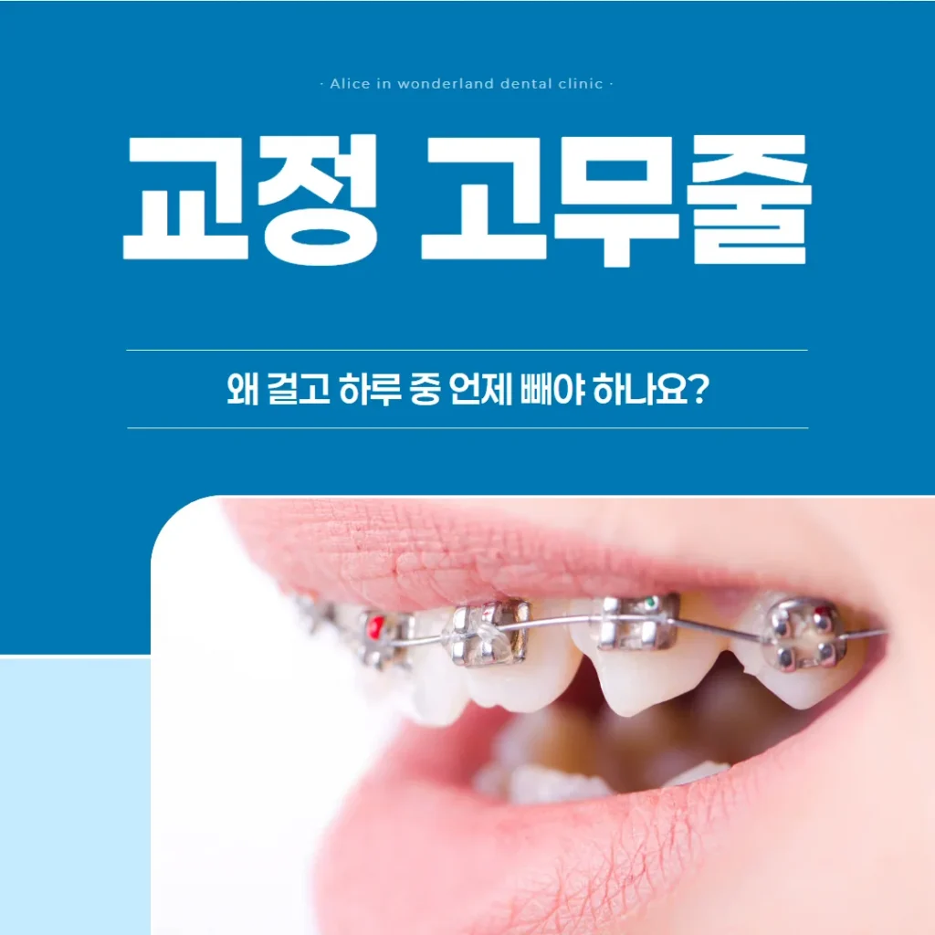교정 고무줄, 왜 걸고 하루 중 언제 빼야 하나요?