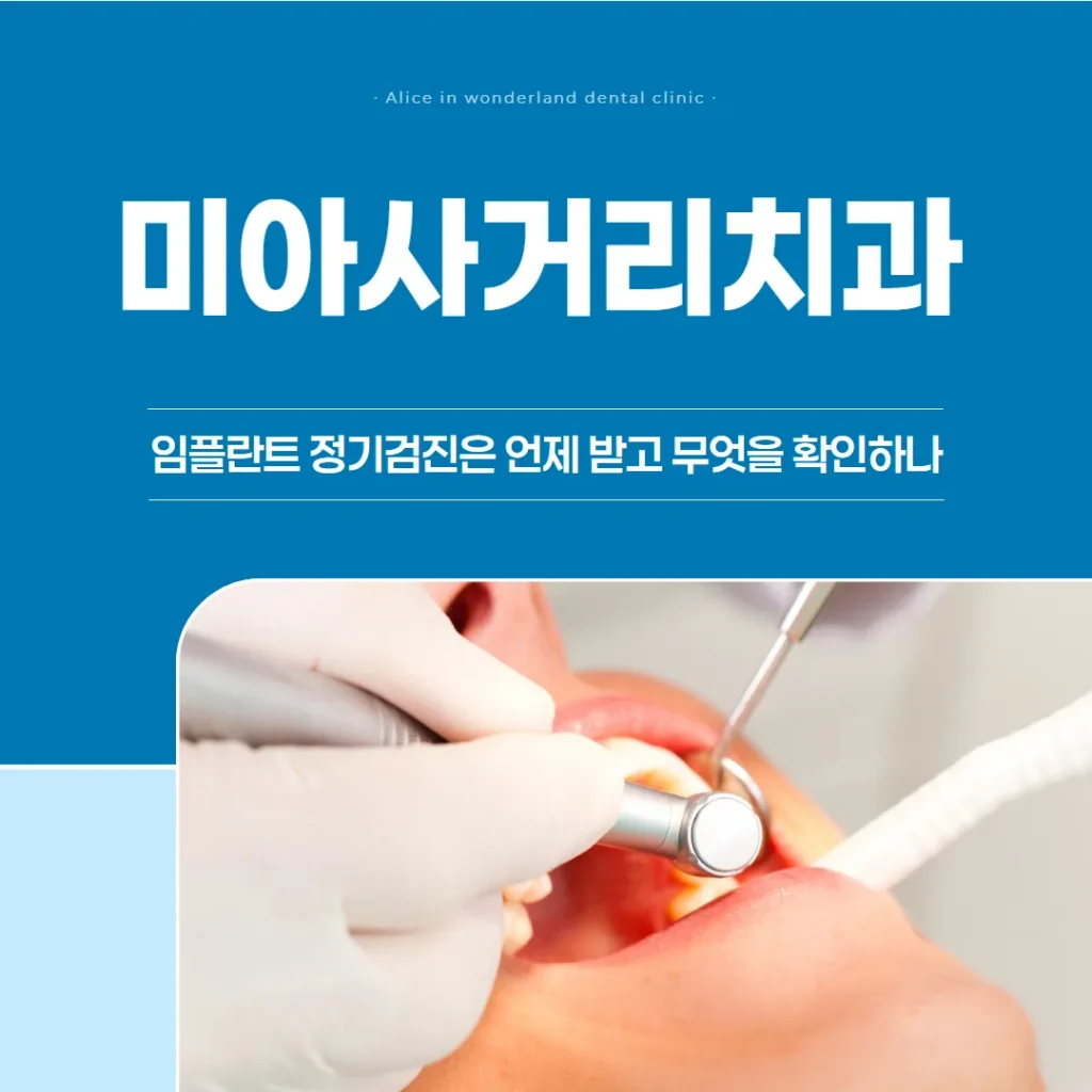 미아사거리치과, 임플란트 정기검진은 언제 받고 무엇을 확인하나