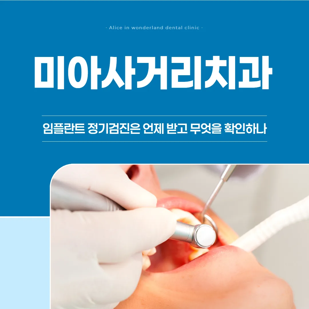 미아사거리치과, 임플란트 정기검진은 언제 받고 무엇을 확인하나