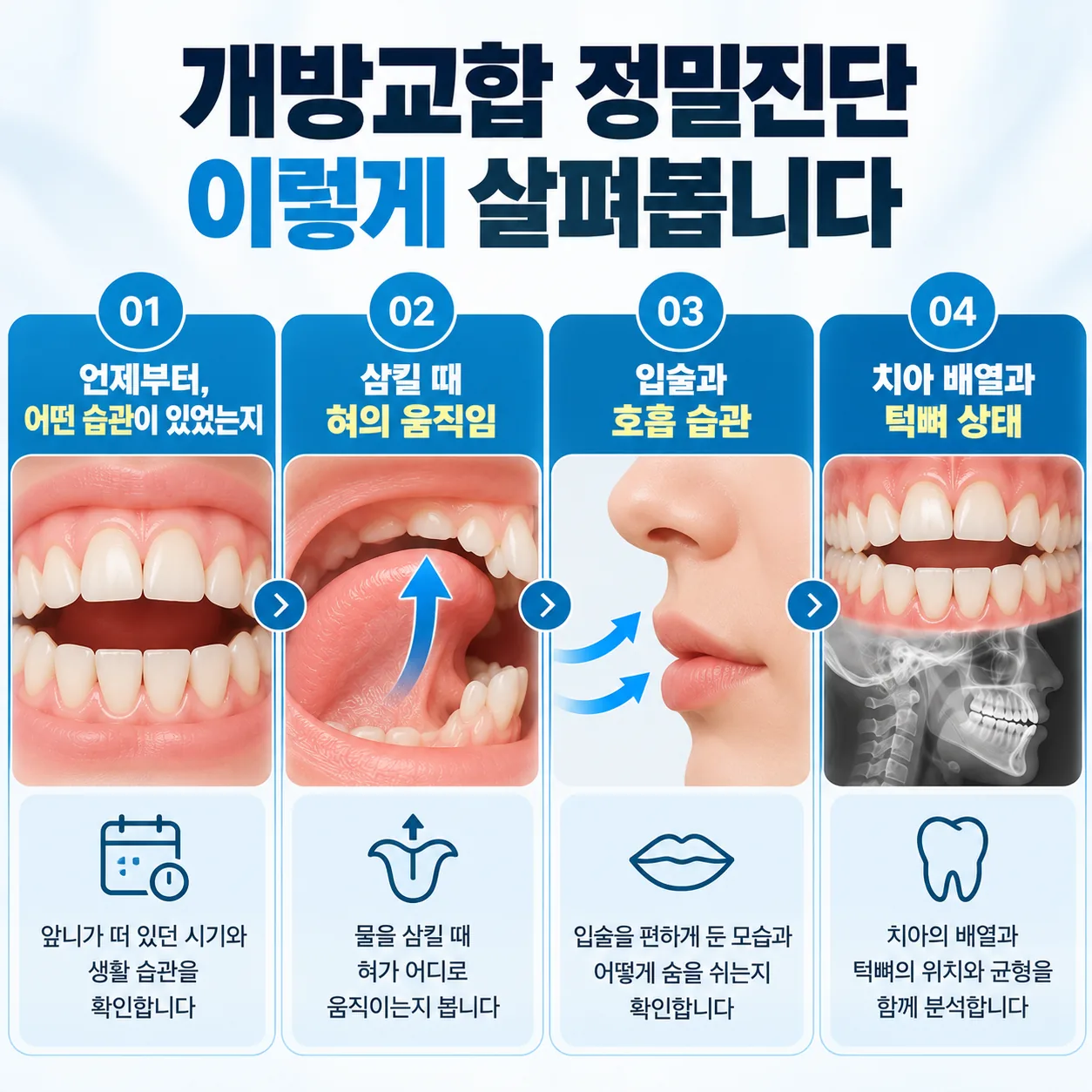 개방교합 정밀진단에서 문진과 혀 움직임, 치아 배열과 턱뼈 상태를 살피는 순서 그림