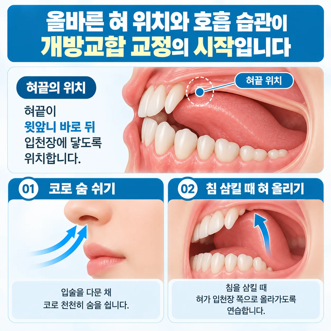 혀끝을 윗앞니 뒤 입천장에 두고 코로 숨 쉬는 혀 위치 연습 그림