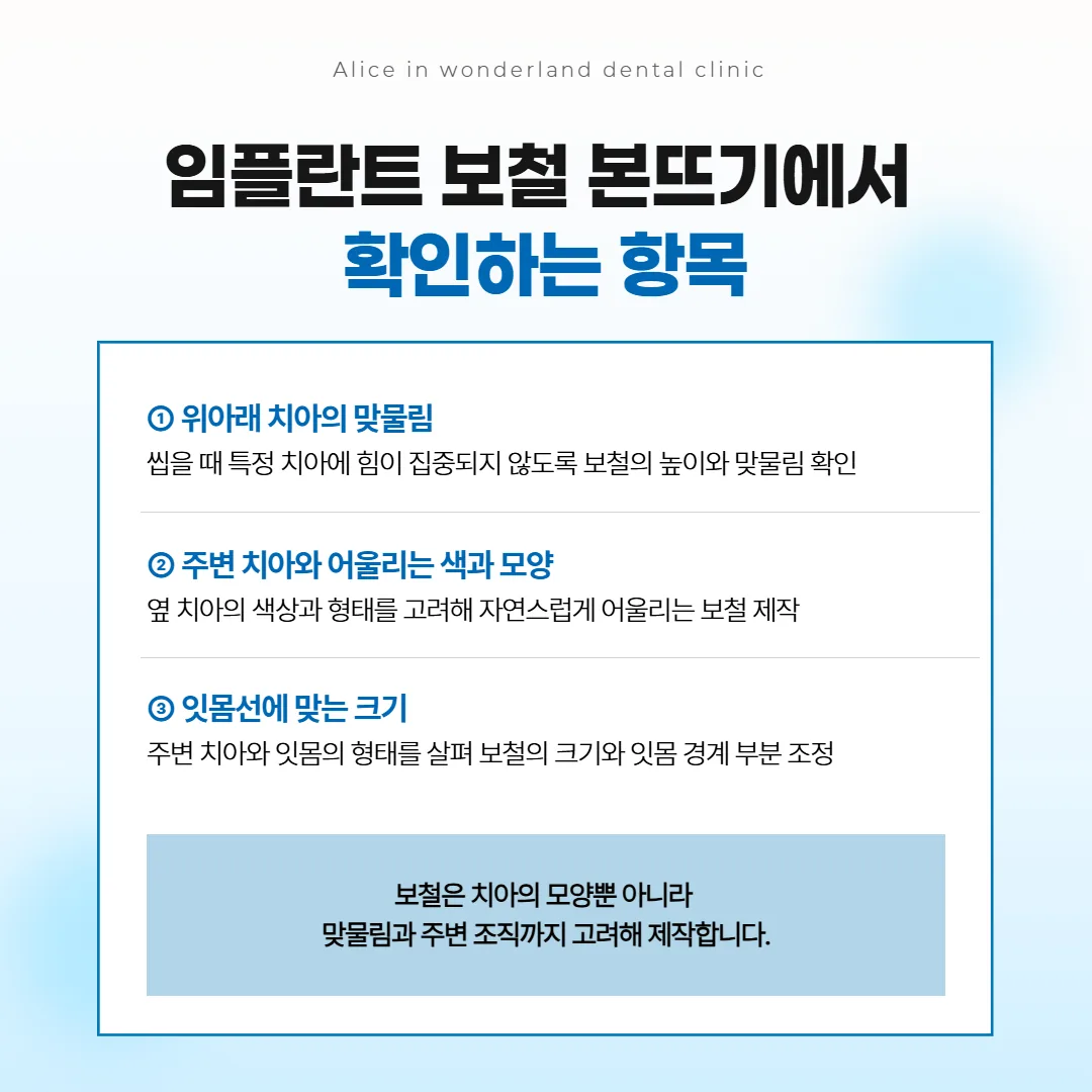 임플란트 보철 본뜨기에서 맞추는 맞물림 높이와 색, 모양, 잇몸선 세 가지 카드 그림