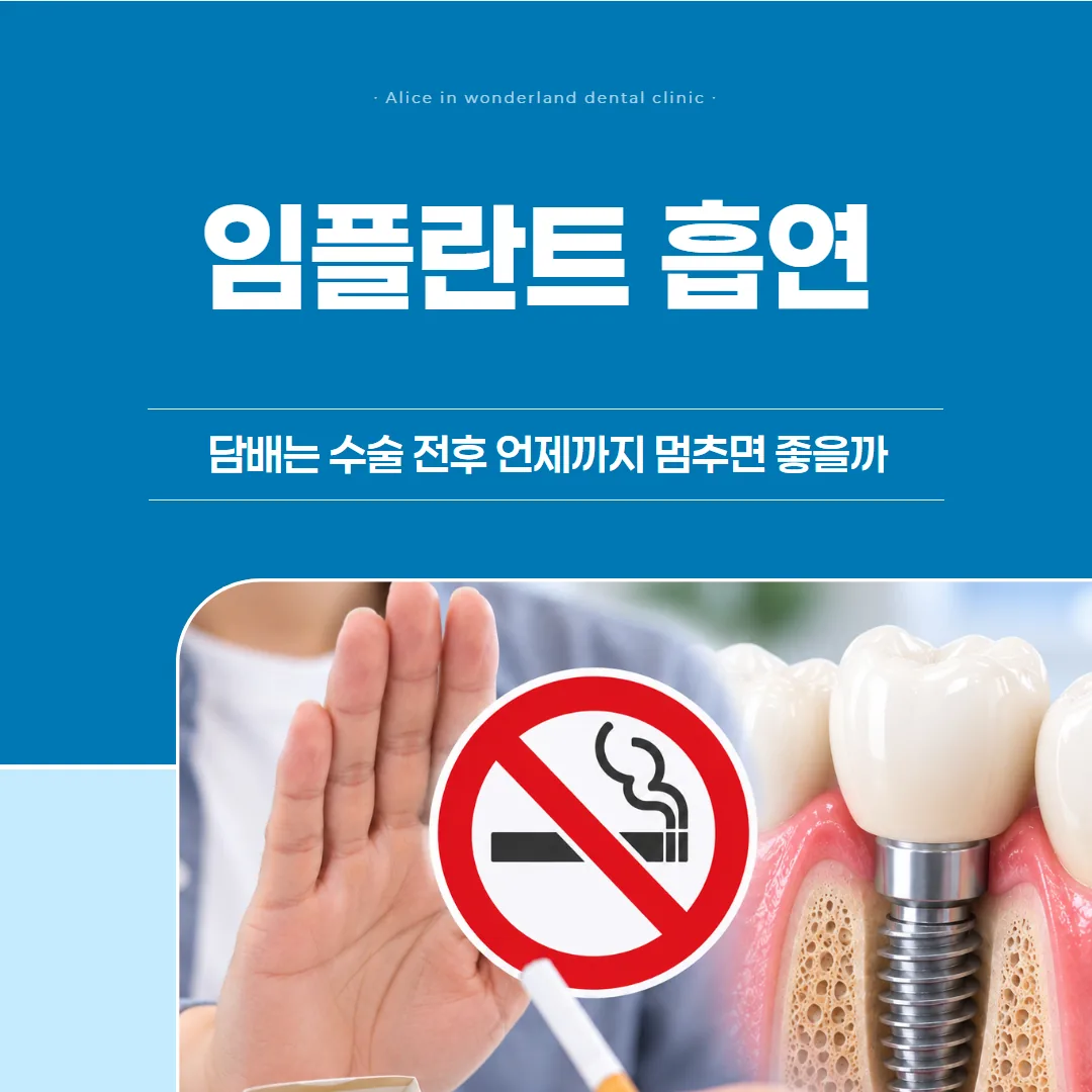 임플란트 흡연, 담배는 수술 전후 언제까지 멈추면 좋을까