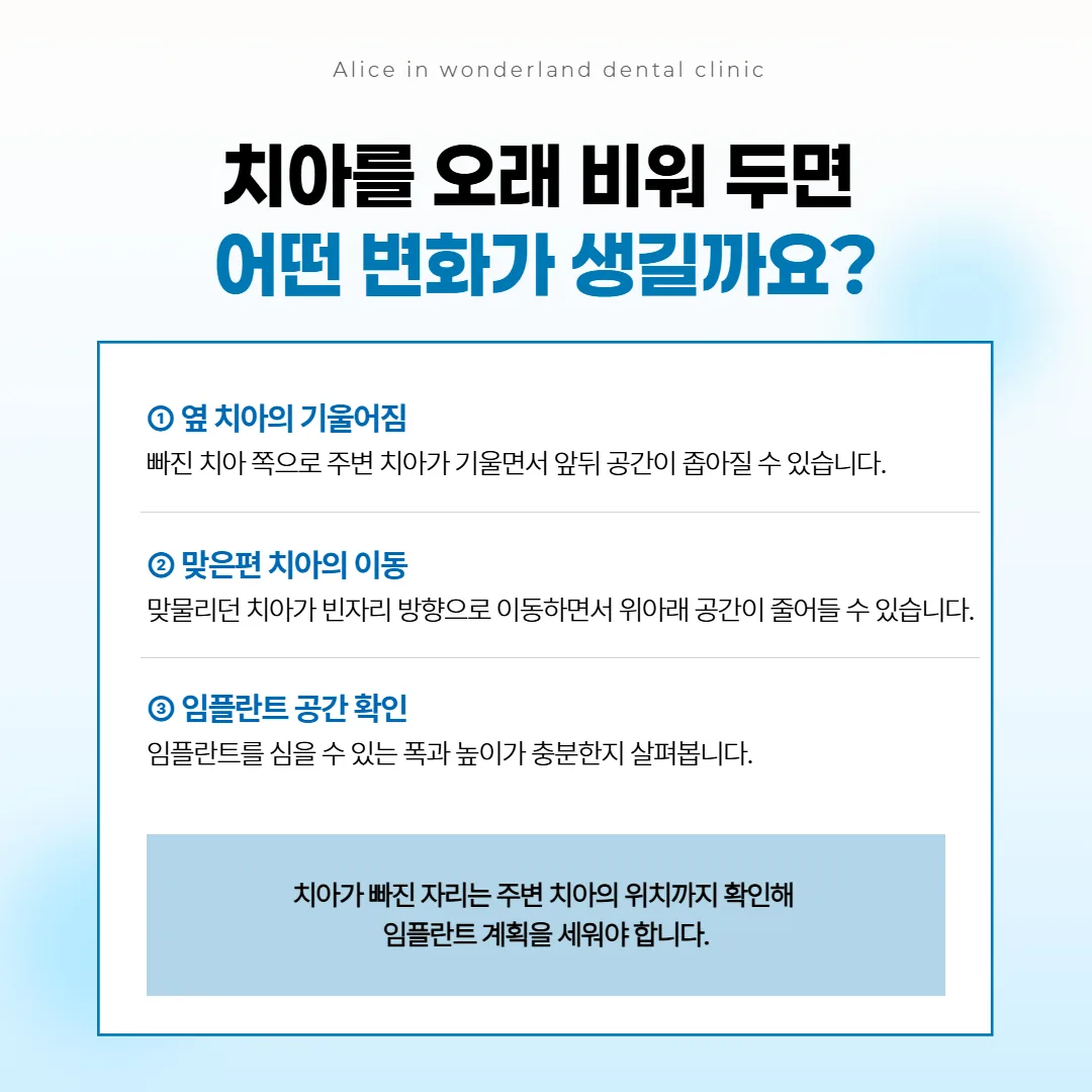 빈자리 옆 치아가 기울고 맞은편 치아가 내려와 임플란트 자리의 폭과 높이가 줄어드는 방향을 나타낸 치아 그림