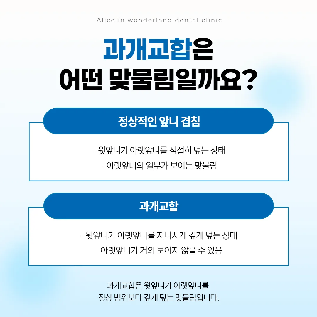 윗앞니가 아랫앞니를 조금 덮는 맞물림과 깊게 덮는 과개교합을 옆에서 비교한 선 그림