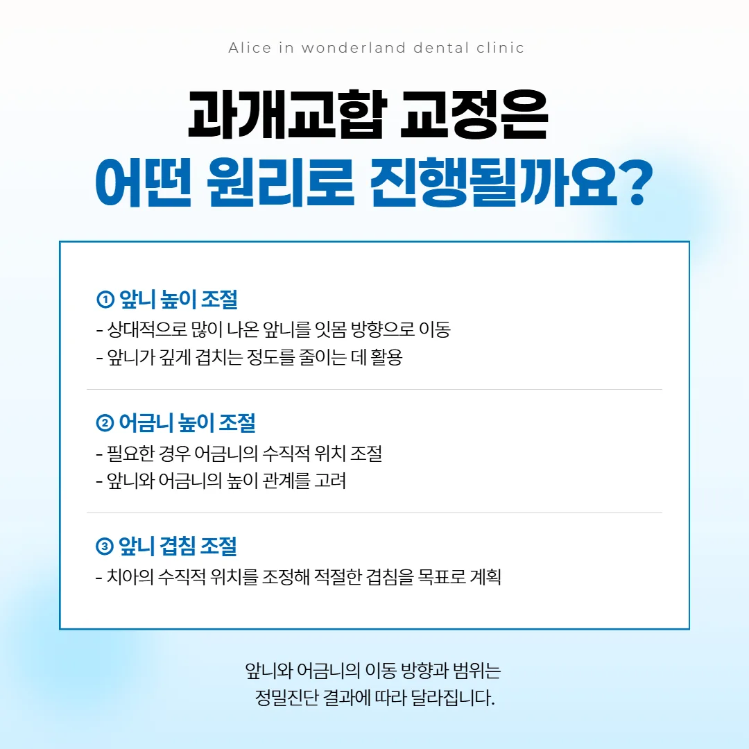 앞니와 어금니의 높이를 맞춰 앞니 겹침을 고르게 하는 교정 원리 그림