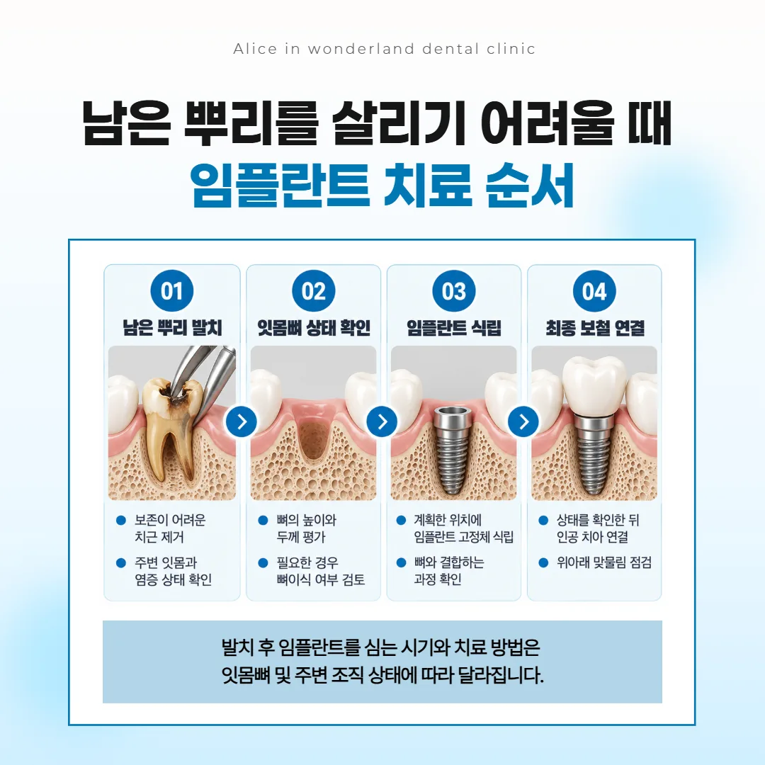 살리기 어려운 뿌리를 뽑은 뒤 잇몸뼈 상태를 살펴 임플란트로 이어지는 네 칸 흐름 그림
